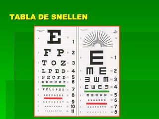 TABLA DE SNELLEN 