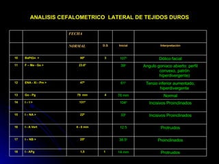 ANALISIS CEFALOMETRICO  LATERAL DE TEJIDOS DUROS Protruidos 14 mm 1  1,5 I - APg 18 Proinclinados 38.5 0 25º I – NB >  17 Protruidos 12.5 4 - 6 mm I - A Vert 16 Incisivos Proinclinados 33 0 22º I – NA >  15 Incisivos Proinclinados 104 0 131º I – I > 14 Normal 76 mm 4 79  mm Go - Pg 13 Tercio inferior aumentado, hiperdivergente 61 0 47º ENA - Xi - Pm > 12 Angulo goniaco abierto: perfil convexo, patrón hiperdivergente) 39 0 23.6º F – Me - Go > 11 Dólico facial 107 0 3 90º BaPtGn  > 10 Interpretación Inicial D.S NORMAL FECHA 