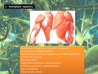 1. Hemiplejia espástica.




             Hemiplejía con hipertonía muscular. Contractura
             Acentuacion de pliegues faciales
             Paralisis predominante en musculos de funcion diferenciada
             como los de la mano
             Marcha de Todd
             Hiperreflexia profunda y osteotendinosa
             Arreflexia superficial o cutaneomucosa
             Signo de Babinski
             Clonus de pie y rótula
 