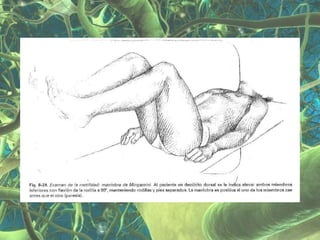 Presentación Sindrome Piramidal