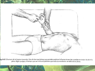 Presentación Sindrome Piramidal