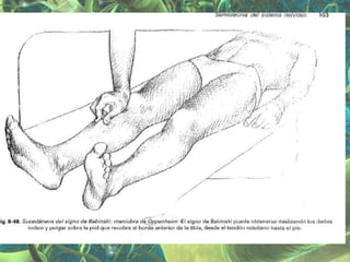 Presentación Sindrome Piramidal