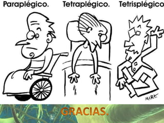 Presentación Sindrome Piramidal