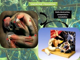 SINDROME PIRAMIDAL

                 Daño destructivo,
                   compresivo o
                    metabólico
 