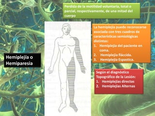 Perdida de la motilidad voluntaria, total o
               parcial, respectivamente, de una mitad del
               cuerpo

                                 La hemiplejía puede reconocerse
                                 asociada con tres cuadros de
                                 características semiológicas
                                 distintas:
                                 1. Hemiplejia del paciente en
                                     coma.
                                 2. Hemiplejia fláccida.
Hemiplejía o                     3. Hemiplejia Espastica.
Hemiparesia
                                  Según el diagnóstico
                                  Topográfico de la Lesión:
                                  1. Hemiplejías directas
                                  2. Hemiplejías Alternas
 