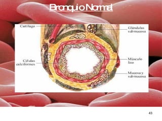 Bronquio Normal 