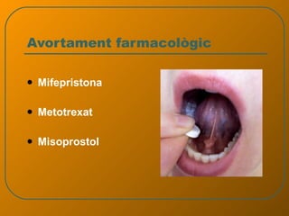 Avortament farmacològic Mifepristona Metotrexat Misoprostol 