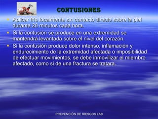 contusiones Aplicar frío localmente sin contacto directo sobre la piel durante 20 minutos cada hora. Si la contusión se produce en una extremidad se mantendrá levantada sobre el nivel del corazón. Si la contusión produce dolor intenso, inflamación y endurecimiento de la extremidad afectada o imposibilidad de efectuar movimientos, se debe inmovilizar el miembro afectado, como si de una fractura se tratara. 
