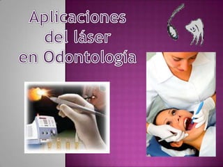 Aplicaciones  del láser  en Odontología 