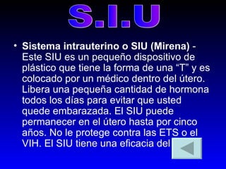 Sistema intrauterino o SIU (Mirena)  - Este SIU es un pequeño dispositivo de plástico que tiene la forma de una “T” y es colocado por un médico dentro del útero. Libera una pequeña cantidad de hormona todos los días para evitar que usted quede embarazada. El SIU puede permanecer en el útero hasta por cinco años. No le protege contra las ETS o el VIH. El SIU tiene una eficacia del 99%.  S.I.U 