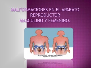 MALFORMACIONES EN EL APARATO REPRODUCTOR  MASCULINO Y FEMENINO. 