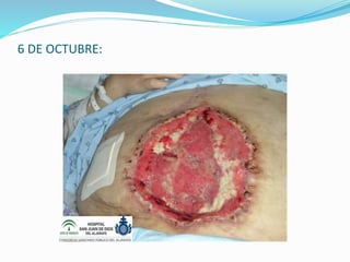 6 DE OCTUBRE:
 