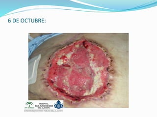 6 DE OCTUBRE:
 