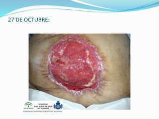 27 DE OCTUBRE:
 