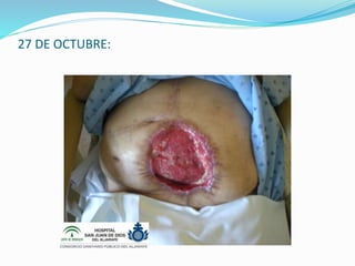 27 DE OCTUBRE:
 