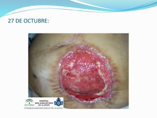 27 DE OCTUBRE:
 