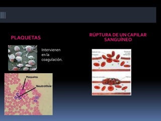 PLAQUETASRÚPTURA DE UN CAPILAR SANGUÍNEOIntervienen en la coagulación.