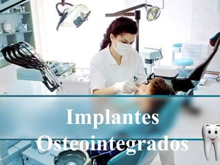 Implantes Osteointegrados 