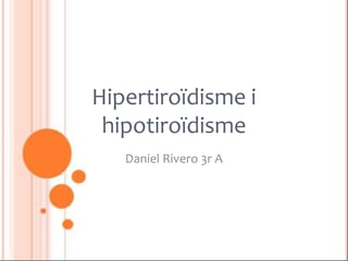 Hipertiroïdisme i hipotiroïdisme Daniel Rivero 3r A 