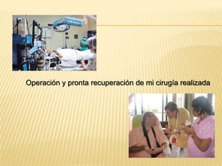 Operación y pronta recuperación de mi cirugía realizada