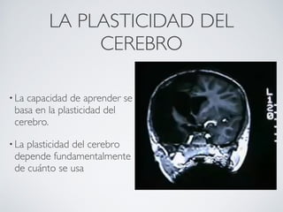 LA PLASTICIDAD DEL
             CEREBRO

• Lacapacidad de aprender se
 basa en la plasticidad del
 cerebro.

• Laplasticidad del cerebro
 depende fundamentalmente
 de cuánto se usa
 