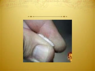 Tortillas de patatas