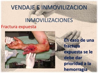 VENDAJE E INMOVILIZACION
           INMOVILIZACIONES
Fractura expuesta

                        En caso de una
                        fractura
                        expuesta se le
                        debe dar
                        prioridad a la
                        hemorragia
 