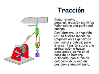 Como término
general, tracción significa
halar sobre una parte del
cuerpo.
Casi siempre, la tracción
utiliza fuerza mecánica
(algunas veces generada
por pesas y poleas) para
ejercer tensión sobre una
articulación o hueso
desplazado, como en el
caso de un hombro
dislocado, con el fin de
colocarlo de nuevo en
posición e inmovilizarlo.
 