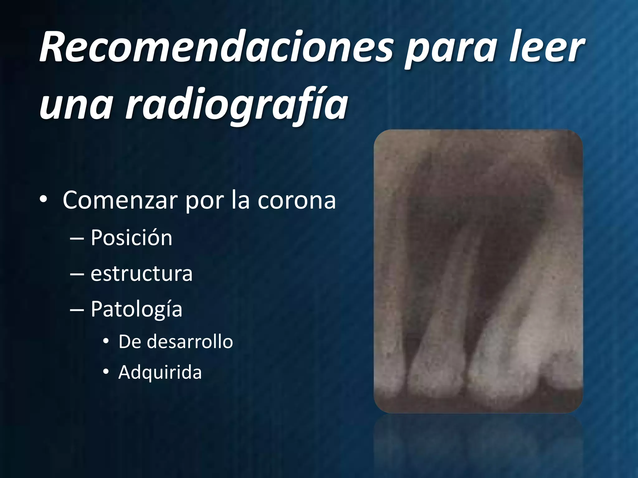 Recomendaciones para leer
una radiografía
• Comenzar por la corona
  – Posición
  – estructura
  – Patología
     • De desarrollo
     • Adquirida
 