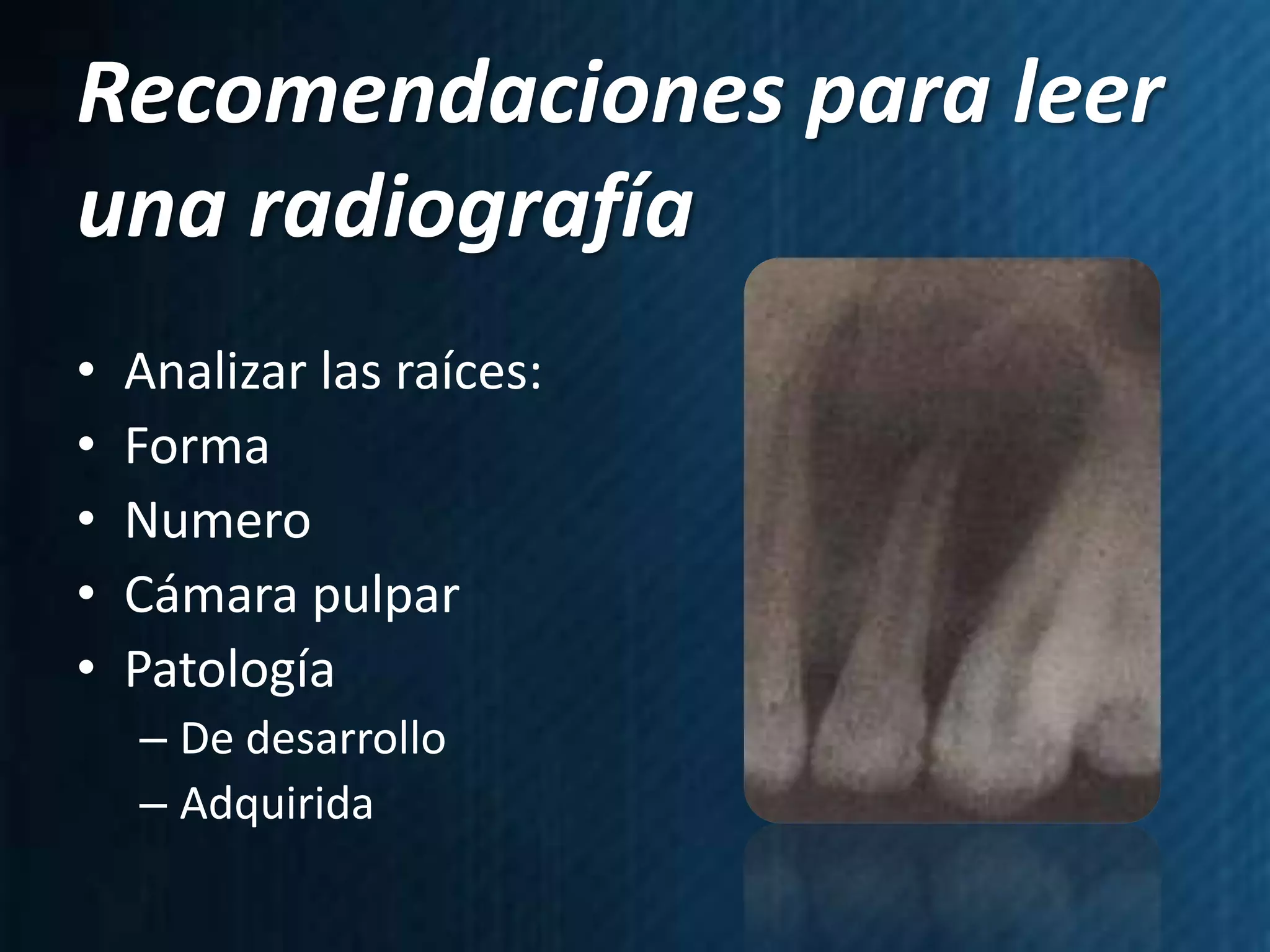 Recomendaciones para leer
una radiografía
•   Analizar las raíces:
•   Forma
•   Numero
•   Cámara pulpar
•   Patología
    – De desarrollo
    – Adquirida
 