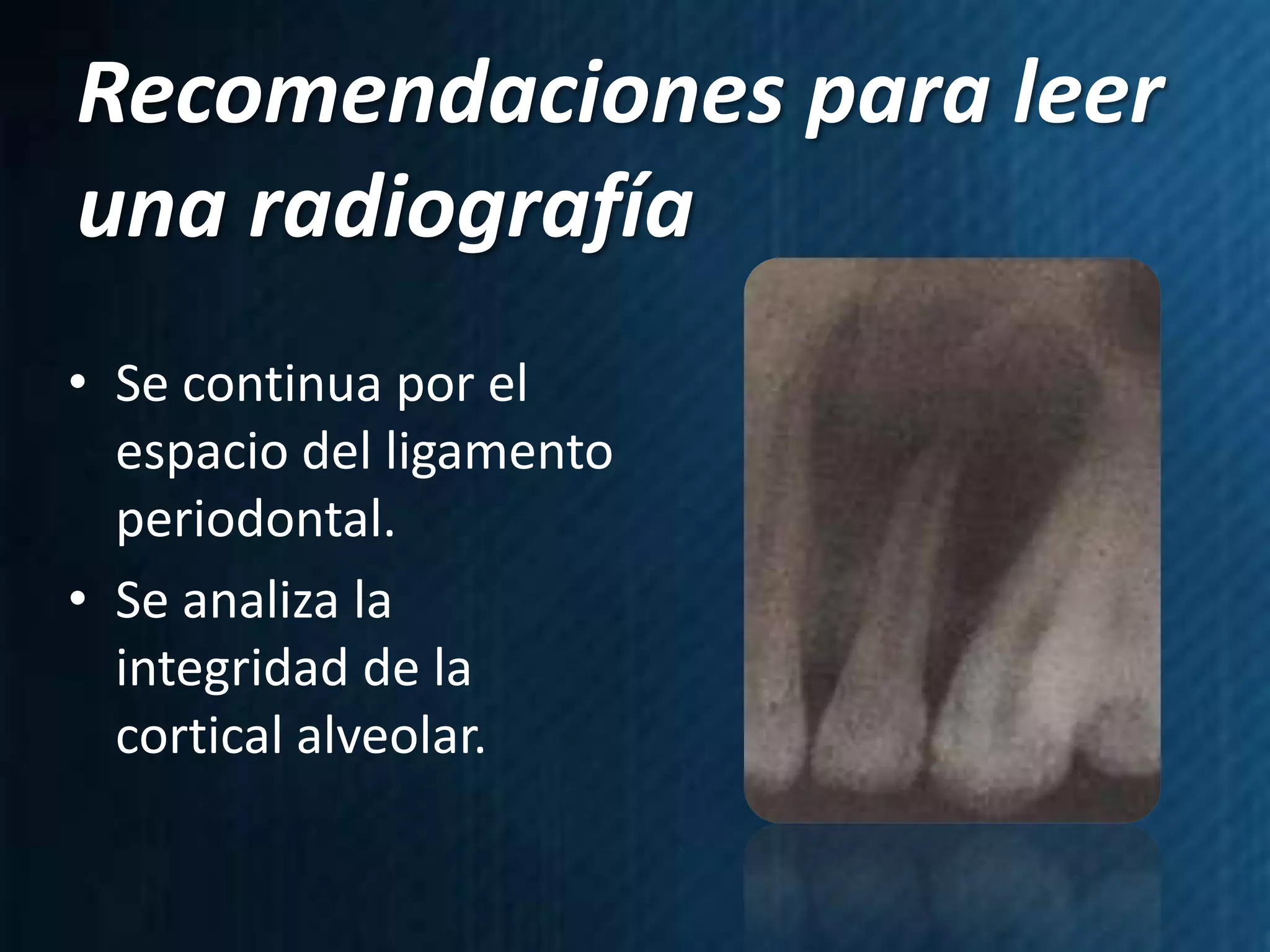 Recomendaciones para leer
una radiografía
• Se continua por el
  espacio del ligamento
  periodontal.
• Se analiza la
  integridad de la
  cortical alveolar.
 