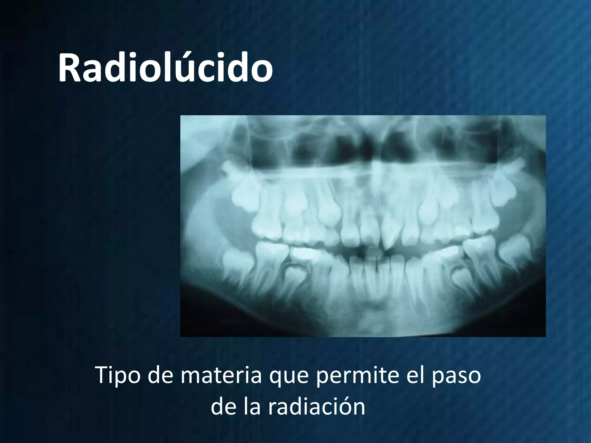 Radiolúcido




 Tipo de materia que permite el paso
           de la radiación
 