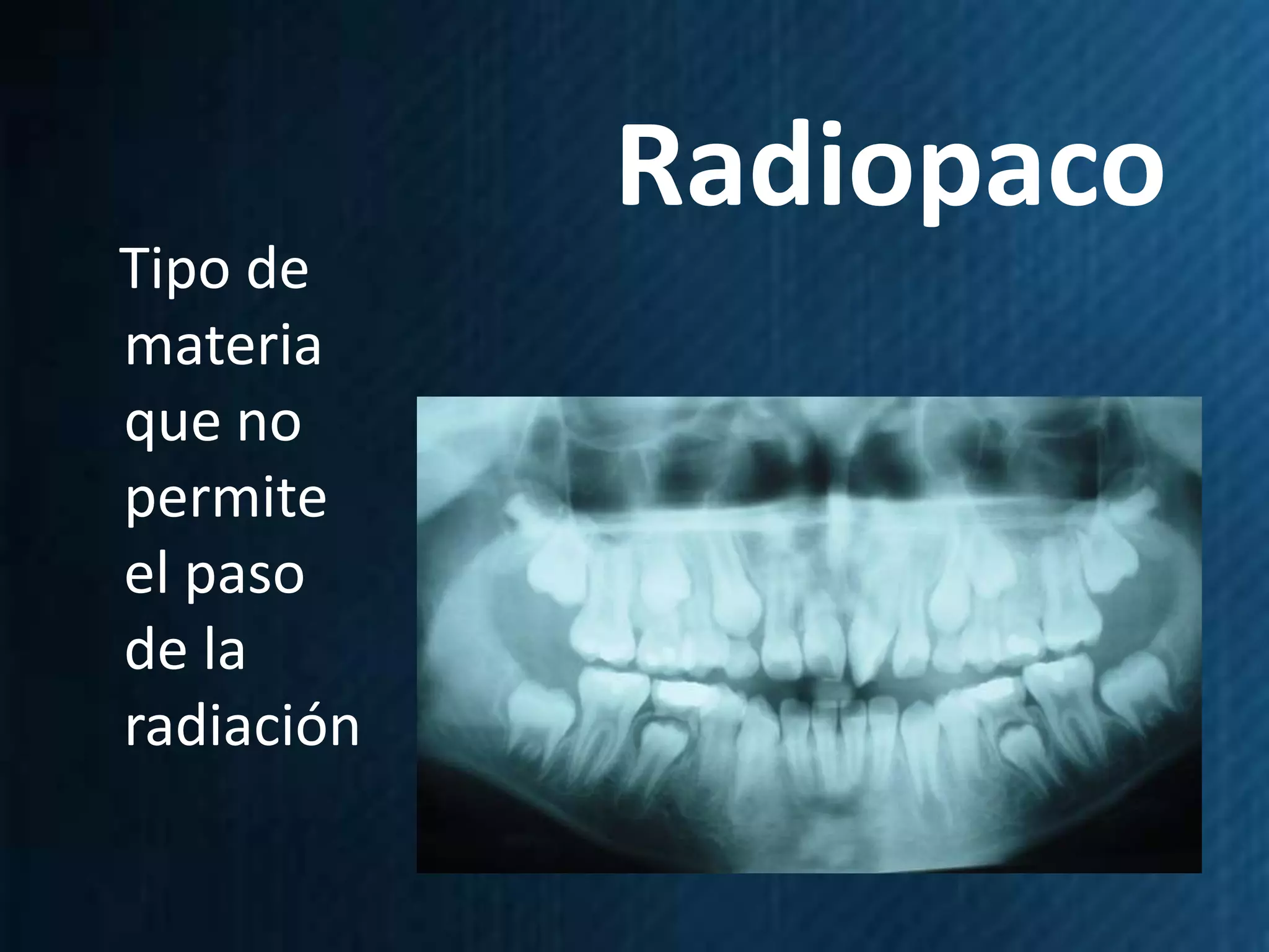 Radiopaco
Tipo de
materia
que no
permite
el paso
de la
radiación
 