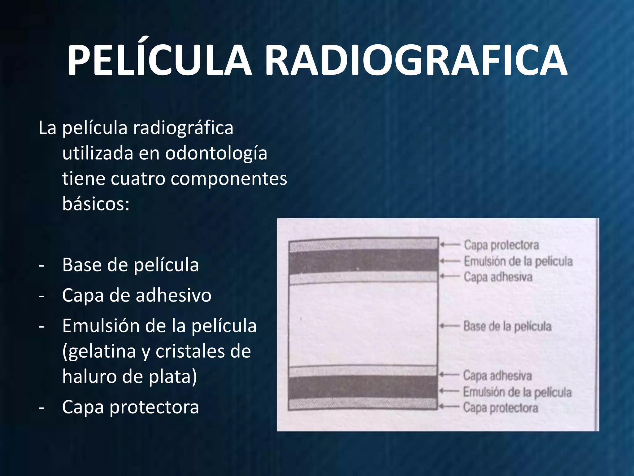 PELÍCULA RADIOGRAFICA
La película radiográfica
   utilizada en odontología
   tiene cuatro componentes
   básicos:

- Base de película
- Capa de adhesivo
- Emulsión de la película
  (gelatina y cristales de
  haluro de plata)
- Capa protectora
 