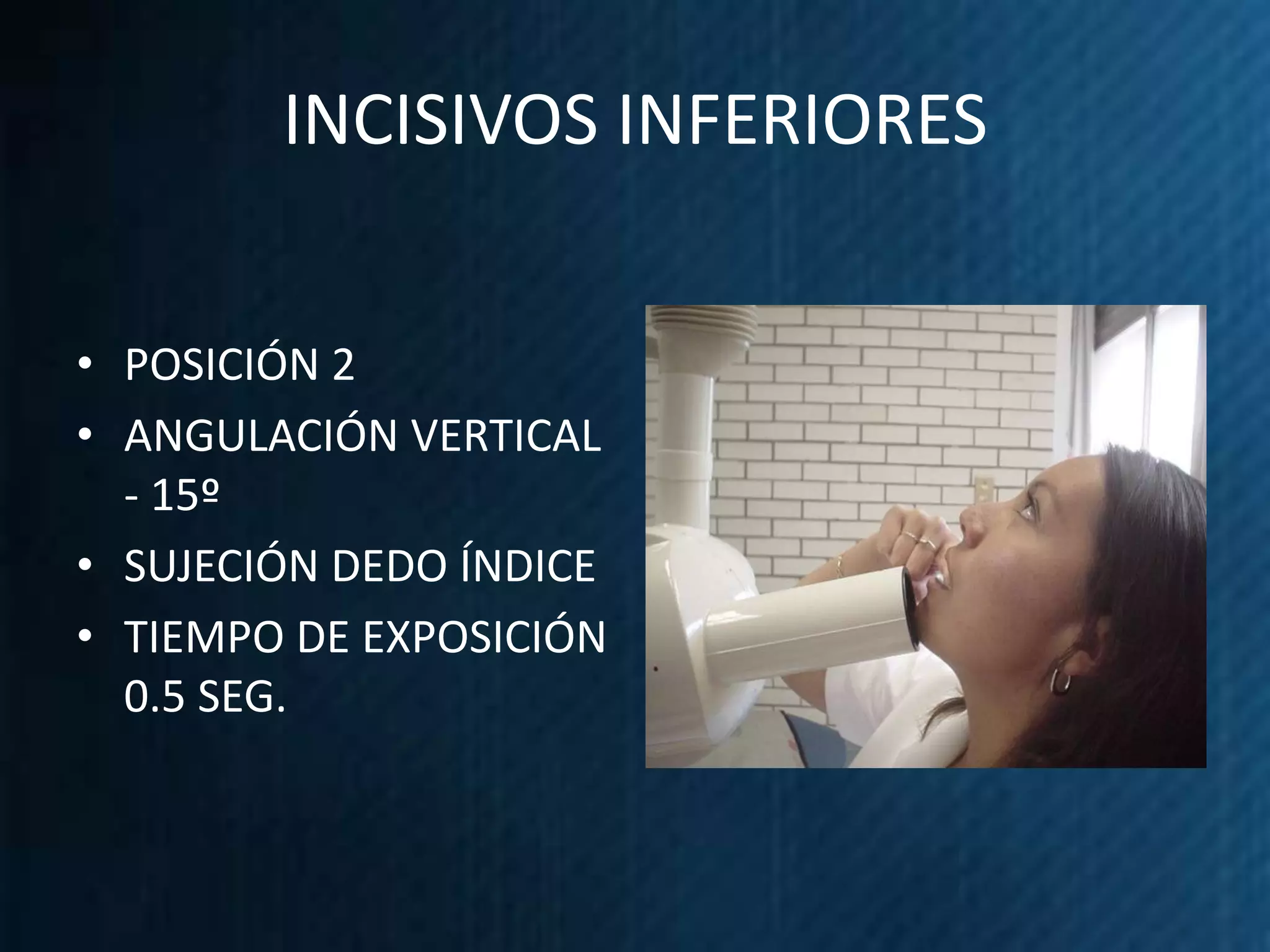 INCISIVOS INFERIORES


• POSICIÓN 2
• ANGULACIÓN VERTICAL
  - 15º
• SUJECIÓN DEDO ÍNDICE
• TIEMPO DE EXPOSICIÓN
  0.5 SEG.
 