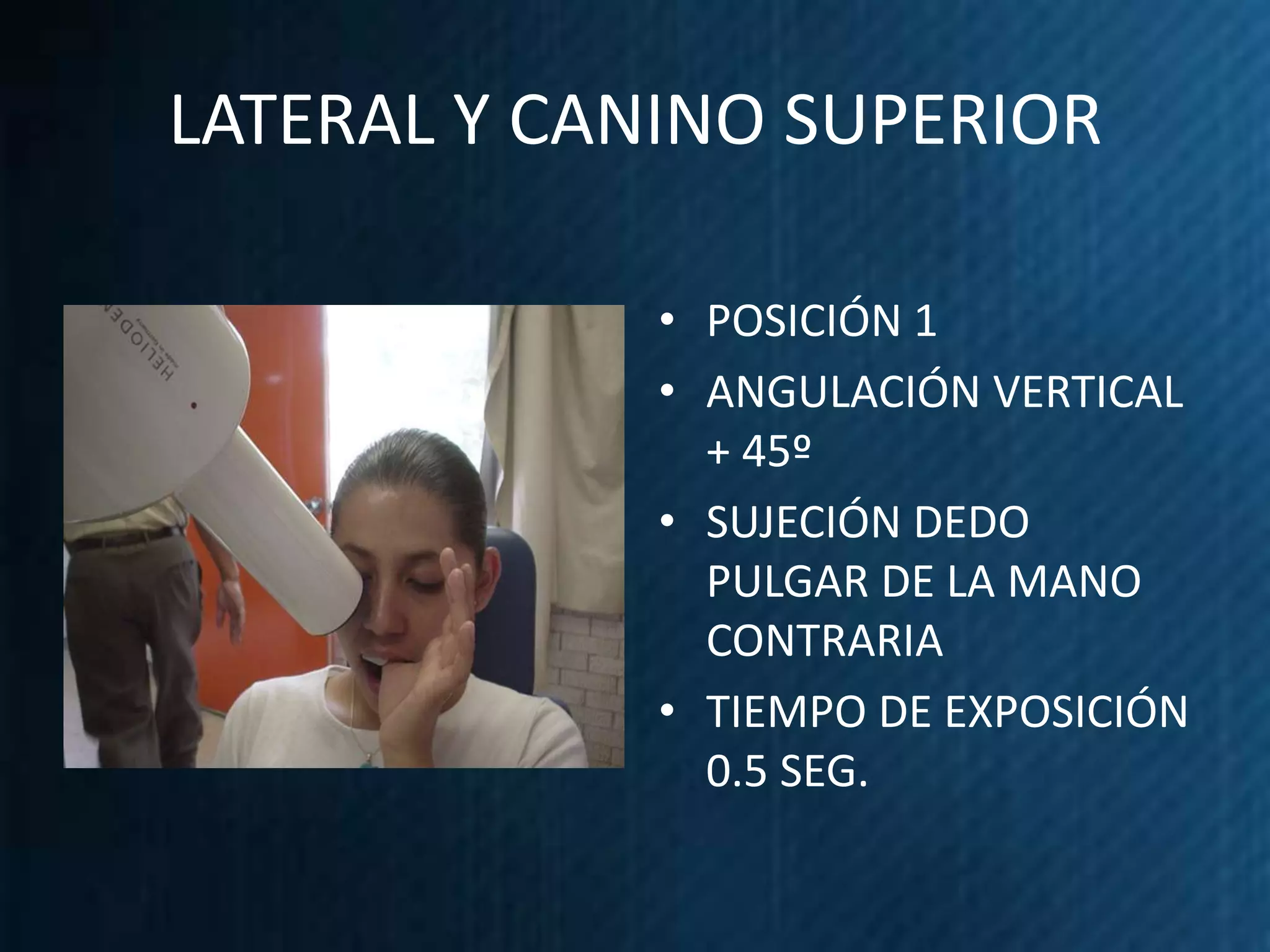 LATERAL Y CANINO SUPERIOR

             • POSICIÓN 1
             • ANGULACIÓN VERTICAL
               + 45º
             • SUJECIÓN DEDO
               PULGAR DE LA MANO
               CONTRARIA
             • TIEMPO DE EXPOSICIÓN
               0.5 SEG.
 