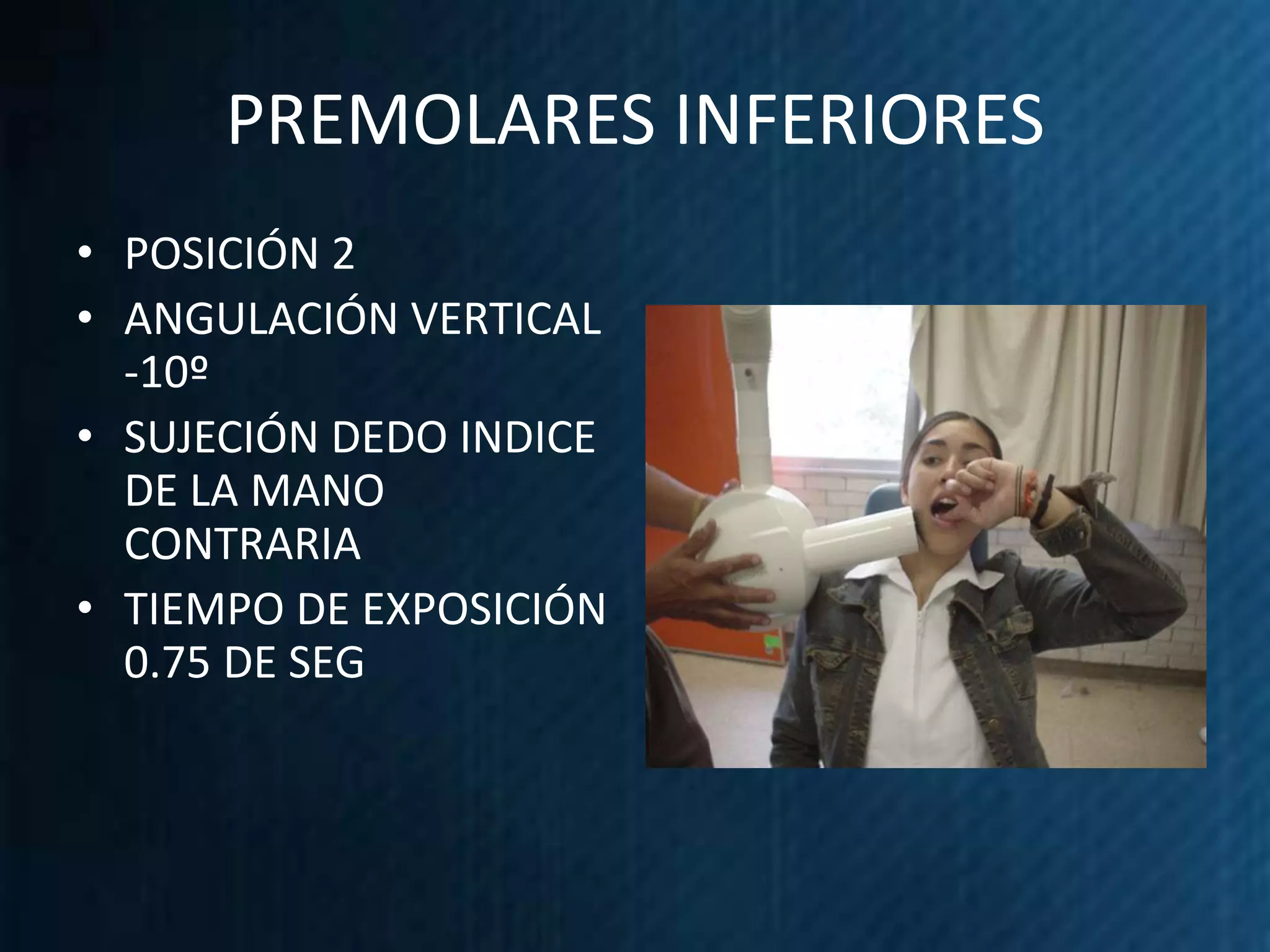 PREMOLARES INFERIORES
• POSICIÓN 2
• ANGULACIÓN VERTICAL
  -10º
• SUJECIÓN DEDO INDICE
  DE LA MANO
  CONTRARIA
• TIEMPO DE EXPOSICIÓN
  0.75 DE SEG
 