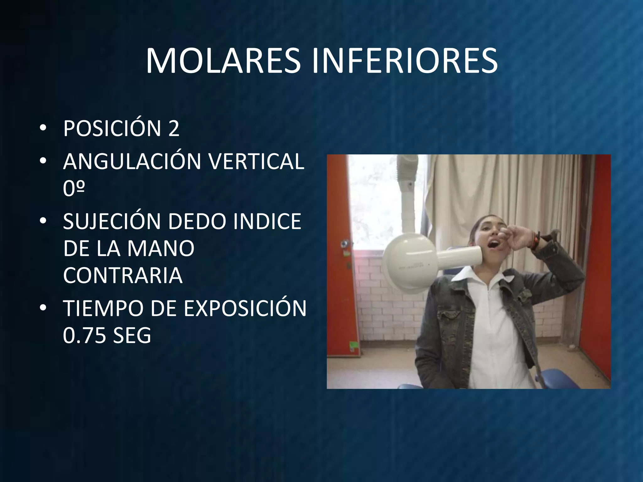 MOLARES INFERIORES
• POSICIÓN 2
• ANGULACIÓN VERTICAL
  0º
• SUJECIÓN DEDO INDICE
  DE LA MANO
  CONTRARIA
• TIEMPO DE EXPOSICIÓN
  0.75 SEG
 