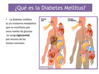 ¿Qué es la Diabetes Mellitus?
• La diabetes mellitus
es un trastorno metabólico
que se manifiesta por
unos niveles de glucosa
 en sangre(glucemia)
por encima de los
límites normales
 