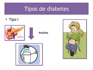 Tipos de diabetes
• Tipo I


                Insulina
 