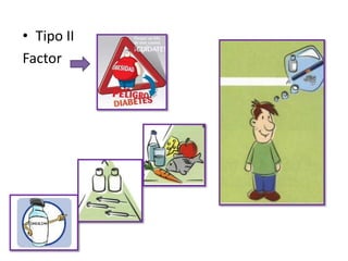 • Tipo II
Factor
 