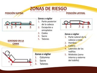 Zonas a vigilar
  1. Parte posterior
     de la cabeza
  2. Escapulas u
     omoplatos
  3. Codos             Zonas a vigilar
  4. Sacro             1. Parte Lateral de la
  5. Talones              cabeza y oreja
                       2. Hombro
                       3. Cadera
                       4. Laterales de las
                          rodillas
Zonas a vigilar        5. Maléolos (zona
1. Columna                interna y externa
2. Sacro                  del tobillo)
3. Talones
 