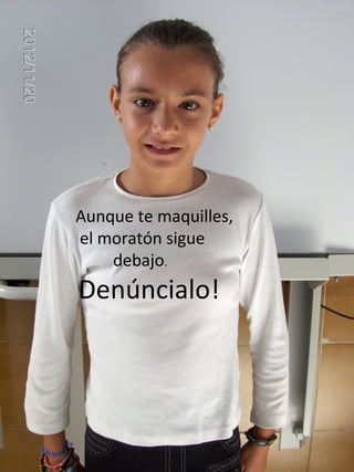 Aunque te maquilles,
el moratón sigue
    debajo.
Denúncialo!
 