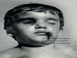 Todo padre maltrata a sus hijos en
fin de dejarlos en los hospitales o
dejarlos locos de tantos golpes que
les dan.
 