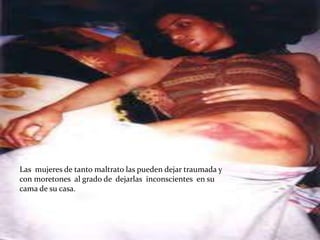 Las mujeres de tanto maltrato las pueden dejar traumada y
con moretones al grado de dejarlas inconscientes en su
cama de su casa.
 
