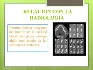RELACION CON LA
           RADIOLOGIA
Permite obtener imágenes
del interior de la cavidad
bucal para poder corregir
algún mal estado de las
estructuras dentarias
 