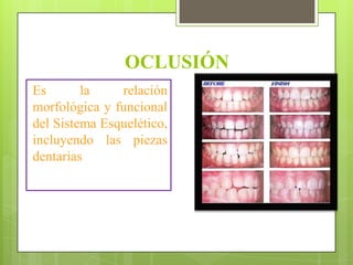 OCLUSIÓN
Es       la    relación
morfológica y funcional
del Sistema Esquelético,
incluyendo las piezas
dentarias
 