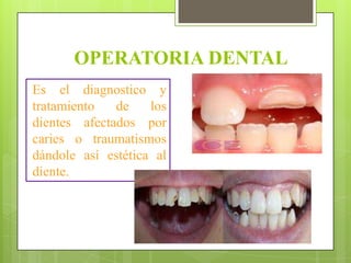 OPERATORIA DENTAL
Es el diagnostico y
tratamiento   de    los
dientes afectados por
caries o traumatismos
dándole así estética al
diente.
 