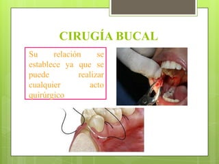 CIRUGÍA BUCAL
Su     relación     se
establece ya que se
puede         realizar
cualquier        acto
quirúrgico
 
