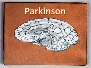Enfermedad de Parkinson en fisioterapia